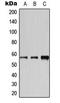 Cytochrome P450 2A6 antibody, LS-C353959, Lifespan Biosciences, Western Blot image 