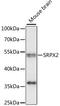 Sushi Repeat Containing Protein X-Linked 2 antibody, LS-C750407, Lifespan Biosciences, Western Blot image 
