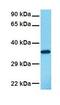 Annexin A3 antibody, GTX30892, GeneTex, Western Blot image 
