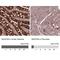 NADH:Ubiquinone Oxidoreductase Subunit A9 antibody, NBP2-13646, Novus Biologicals, Immunohistochemistry paraffin image 