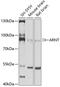 Aryl Hydrocarbon Receptor Nuclear Translocator antibody, 15-676, ProSci, Western Blot image 