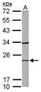 RAB2B, Member RAS Oncogene Family antibody, TA307960, Origene, Western Blot image 