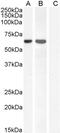 Forkhead Box C2 antibody, PA5-18172, Invitrogen Antibodies, Western Blot image 