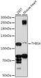 Thrombospondin 4 antibody, 16-605, ProSci, Western Blot image 