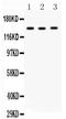Reticulon 3 antibody, LS-C313350, Lifespan Biosciences, Western Blot image 
