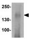 CF Transmembrane Conductance Regulator antibody, GTX31913, GeneTex, Western Blot image 