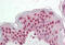 Cyclin Dependent Kinase Inhibitor 1C antibody, MBS248790, MyBioSource, Immunohistochemistry frozen image 