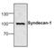 Syndecan 1 antibody, NBP1-45875, Novus Biologicals, Western Blot image 