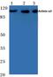 Actinin Alpha 3 (Gene/Pseudogene) antibody, PA5-36233, Invitrogen Antibodies, Western Blot image 