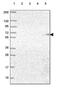 60 kDa lysophospholipase antibody, PA5-64429, Invitrogen Antibodies, Western Blot image 