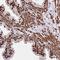 Transducin Beta Like 1 Y-Linked antibody, NBP2-32513, Novus Biologicals, Immunohistochemistry frozen image 