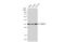 Voltage Dependent Anion Channel 2 antibody, GTX104745, GeneTex, Western Blot image 