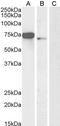 Forkhead Box C1 antibody, GTX25079, GeneTex, Western Blot image 