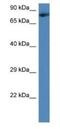 Transmembrane And Coiled-Coil Domains 3 antibody, NBP1-79207, Novus Biologicals, Western Blot image 