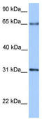 Zinc Finger Protein 394 antibody, TA345436, Origene, Western Blot image 