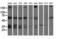 Insulin Like Growth Factor 2 MRNA Binding Protein 2 antibody, LS-C175775, Lifespan Biosciences, Western Blot image 