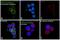 Zeta Chain Of T Cell Receptor Associated Protein Kinase 70 antibody, 700177, Invitrogen Antibodies, Immunofluorescence image 