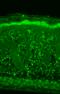 Heat Shock Protein Family B (Small) Member 8 antibody, SMC-187D-P594, StressMarq, Immunohistochemistry paraffin image 