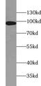 Wolframin ER Transmembrane Glycoprotein antibody, FNab09509, FineTest, Western Blot image 