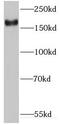 IQ Motif Containing GTPase Activating Protein 3 antibody, FNab04380, FineTest, Western Blot image 