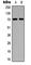 Ribosomal Protein S6 Kinase B1 antibody, abx121722, Abbexa, Western Blot image 