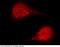 Histone chaperone ASF1A antibody, 100840-T38, Sino Biological, Immunohistochemistry paraffin image 