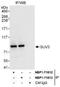 Suv3 Like RNA Helicase antibody, NBP1-71812, Novus Biologicals, Western Blot image 