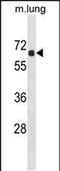 Acyl-CoA Thioesterase 9 antibody, PA5-49048, Invitrogen Antibodies, Western Blot image 