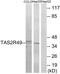 Taste 2 Receptor Member 20 antibody, GTX87677, GeneTex, Western Blot image 