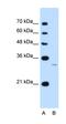 Acyl-CoA Wax Alcohol Acyltransferase 1 antibody, orb325177, Biorbyt, Western Blot image 