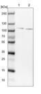 Zinc Finger Protein 598 antibody, NBP1-84658, Novus Biologicals, Western Blot image 