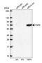 Tyrosyl-TRNA Synthetase antibody, PA5-53883, Invitrogen Antibodies, Western Blot image 