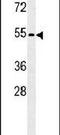 Kruppel Like Factor 17 antibody, PA5-25421, Invitrogen Antibodies, Western Blot image 