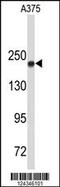DNA Topoisomerase II Alpha antibody, MBS9212108, MyBioSource, Western Blot image 