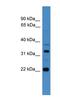 Archaelysin Family Metallopeptidase 2 antibody, NBP1-79621, Novus Biologicals, Western Blot image 