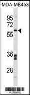 Flavin Containing Dimethylaniline Monoxygenase 5 antibody, 60-965, ProSci, Western Blot image 
