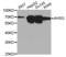 Alpha 2-HS Glycoprotein antibody, STJ22552, St John