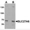 Solute Carrier Family 27 Member 6 antibody, MBS153613, MyBioSource, Western Blot image 