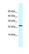 Cold Shock Domain Containing C2 antibody, orb324896, Biorbyt, Western Blot image 