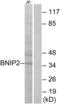 BCL2 Interacting Protein 2 antibody, LS-C119774, Lifespan Biosciences, Western Blot image 