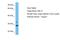 ADP Ribosylation Factor Like GTPase 10 antibody, A18644, Boster Biological Technology, Western Blot image 