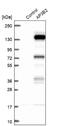 Adaptor Related Protein Complex 3 Subunit Beta 2 antibody, NBP1-81012, Novus Biologicals, Western Blot image 