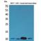 Diazepam Binding Inhibitor, Acyl-CoA Binding Protein antibody, LS-C386960, Lifespan Biosciences, Western Blot image 