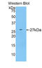 CD22 Molecule antibody, LS-C296417, Lifespan Biosciences, Western Blot image 