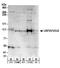 VHL-interacting deubiquitinating enzyme 2 antibody, A301-189A, Bethyl Labs, Western Blot image 