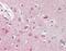 Origin Recognition Complex Subunit 3 antibody, orb137607, Biorbyt, Immunohistochemistry paraffin image 