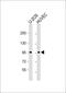 GIT ArfGAP 1 antibody, 62-896, ProSci, Western Blot image 