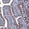 Thioredoxin-related transmembrane protein 2 antibody, HPA040282, Atlas Antibodies, Immunohistochemistry paraffin image 