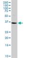 Vasohibin 1 antibody, H00022846-M05, Novus Biologicals, Western Blot image 