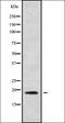 Mitochondrial Ribosomal Protein L30 antibody, orb337902, Biorbyt, Western Blot image 